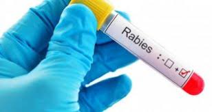 Rabies Vaccine in Clinic One