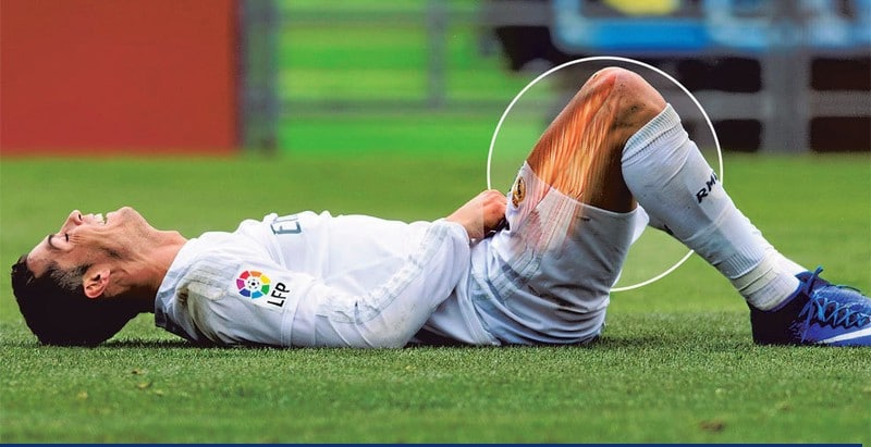 Common Sports Injuries that may occur