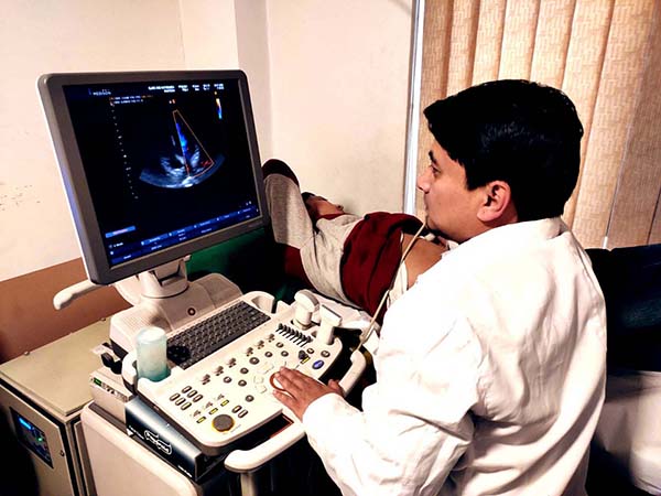 Echocardiography (ECHO) Test in Kathmandu | Performed by Experienced Cardiologists