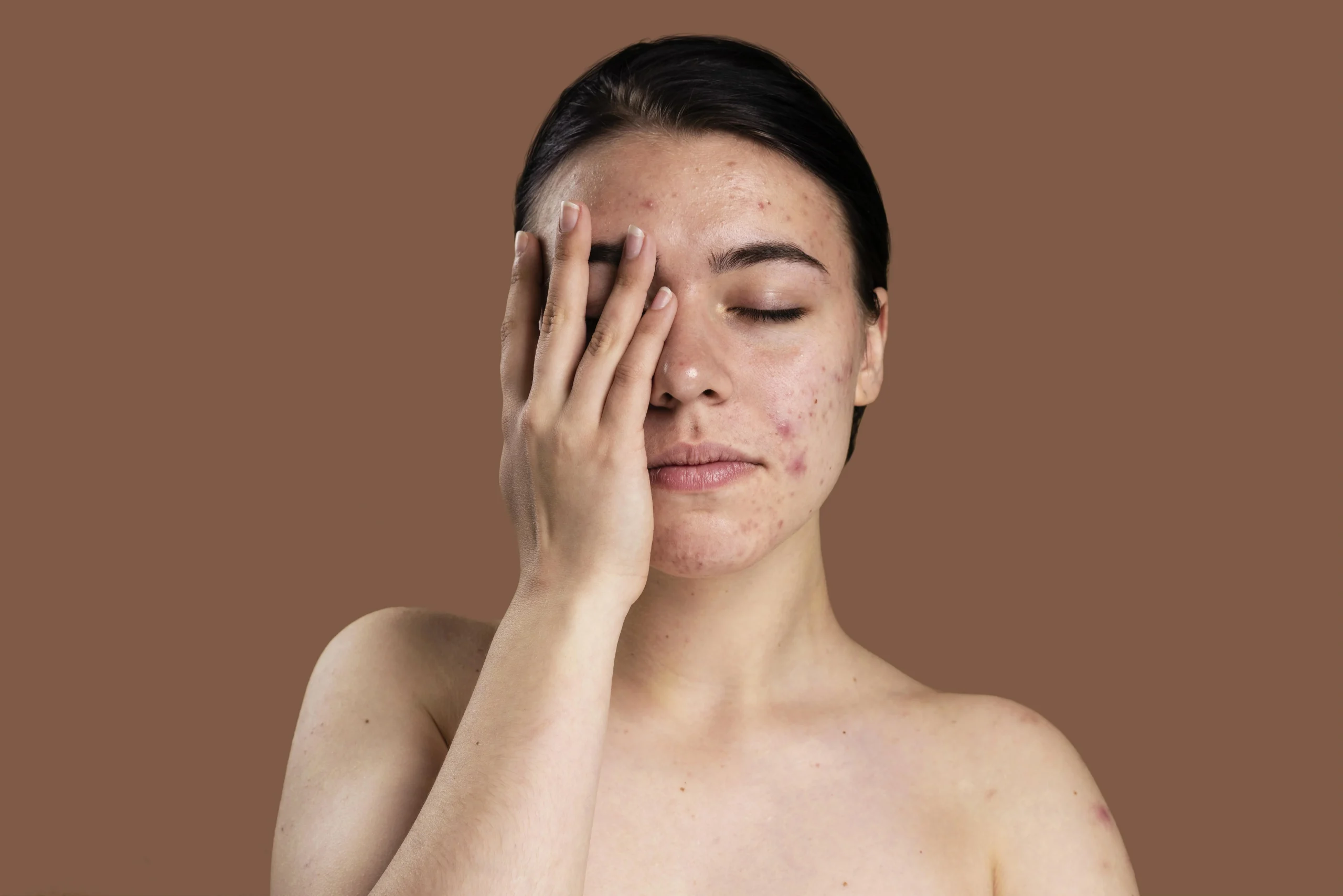 Skin Problems in Summer | How To Prevent Them?