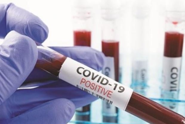 Way Out Of This COVID-19 Pandemic: Plasma Therapy, Or Current Antivirals?