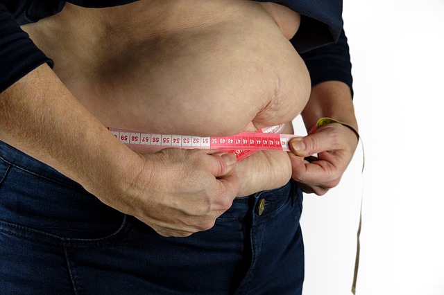 Obesity and diabetes in kathmandu nepal