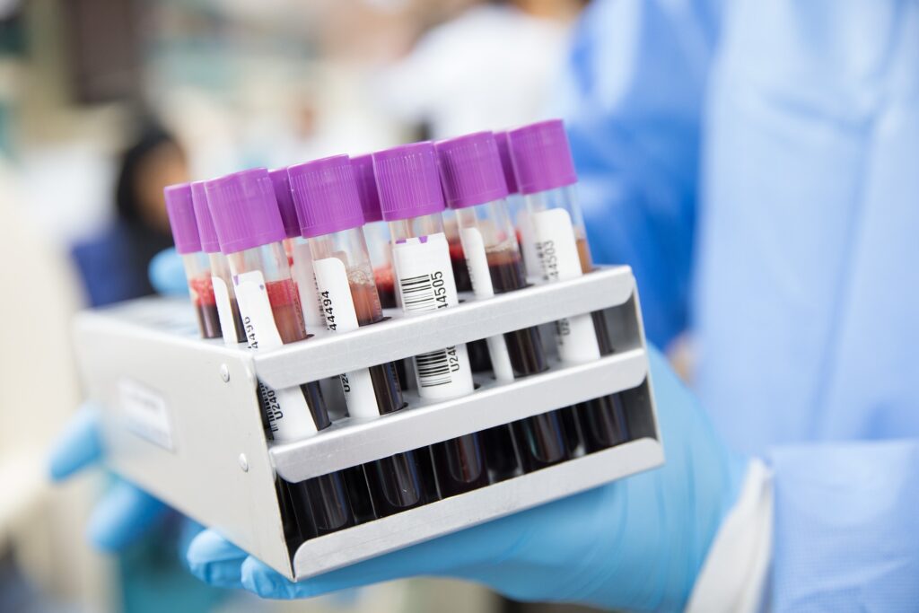 Vitamin B12 tests treatment and injection in Kathmandu Nepal