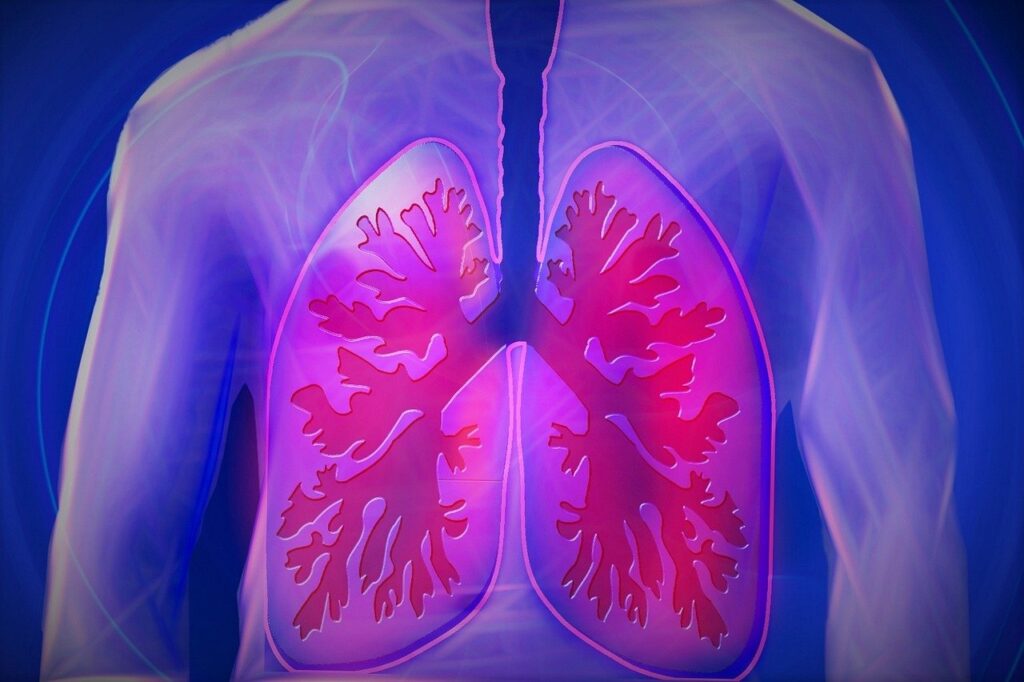 pneumonia and covid-19 affecting lungs