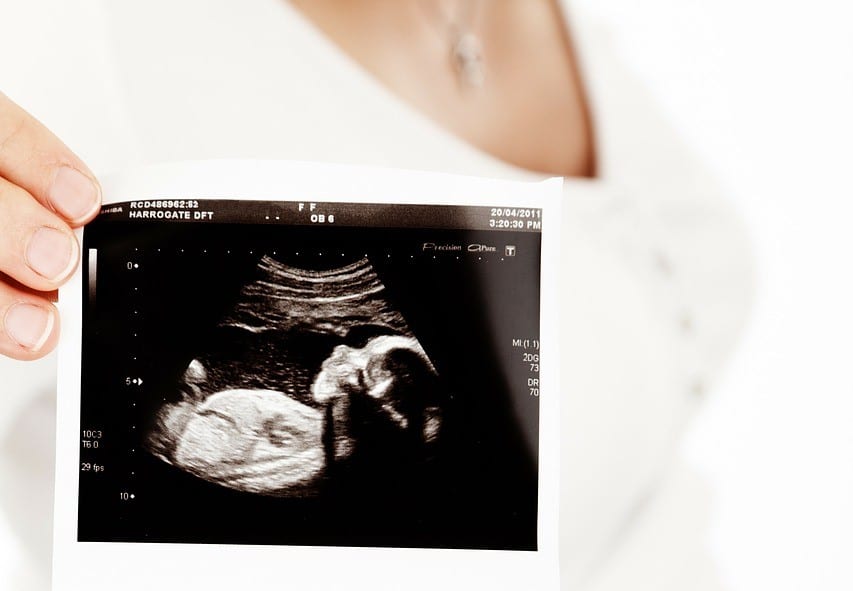 Best Transvaginal (TVS) Ultrasound in Kathmandu, Nepal
