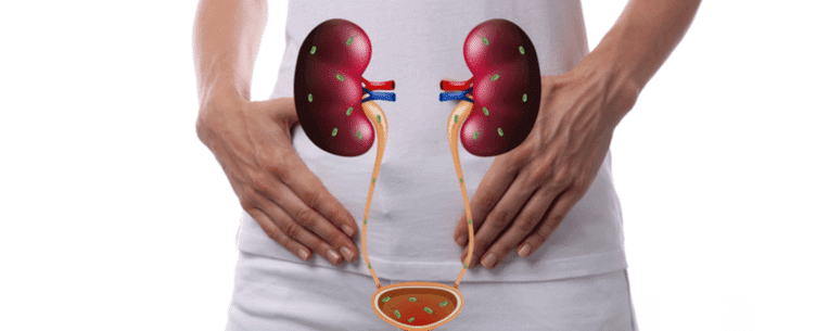 Urinary Tract Infection: Causes, Symptoms, and Treatment