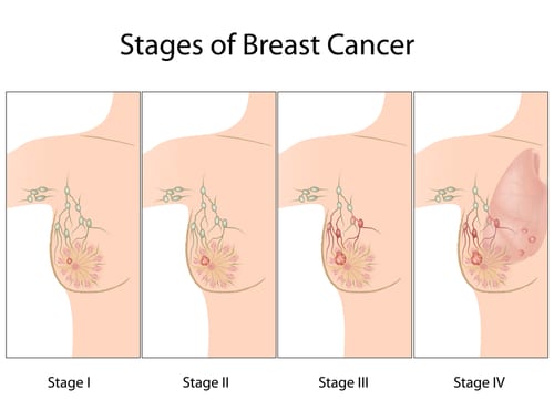 Breast Oncosurgery Department