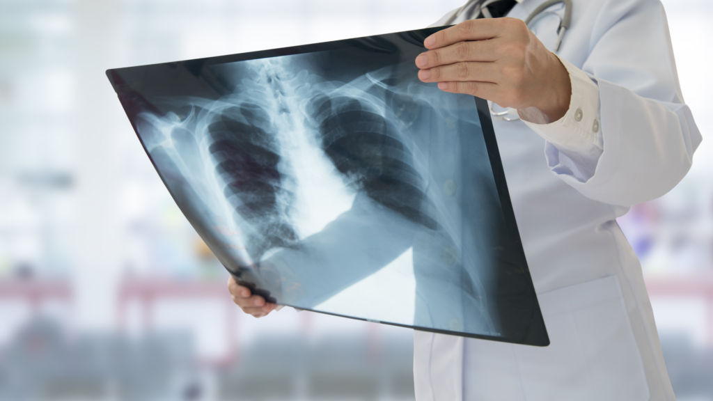 Xray services at Clinic One Bhaktapur Nepal