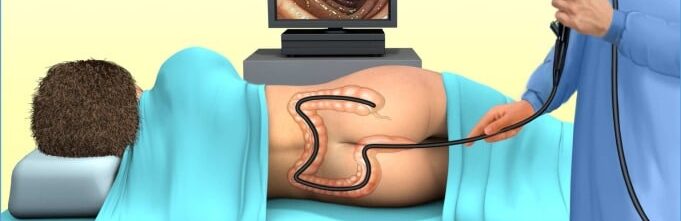 Colonoscopy in Kathmandu, Nepal at Clinic One
