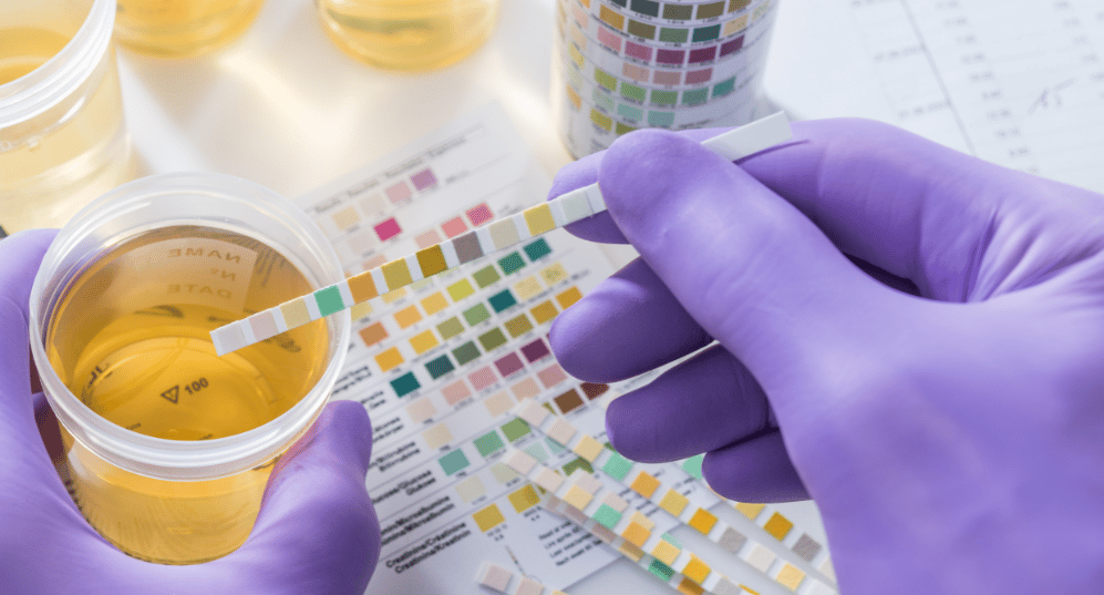 What does your urine color indicates about your health