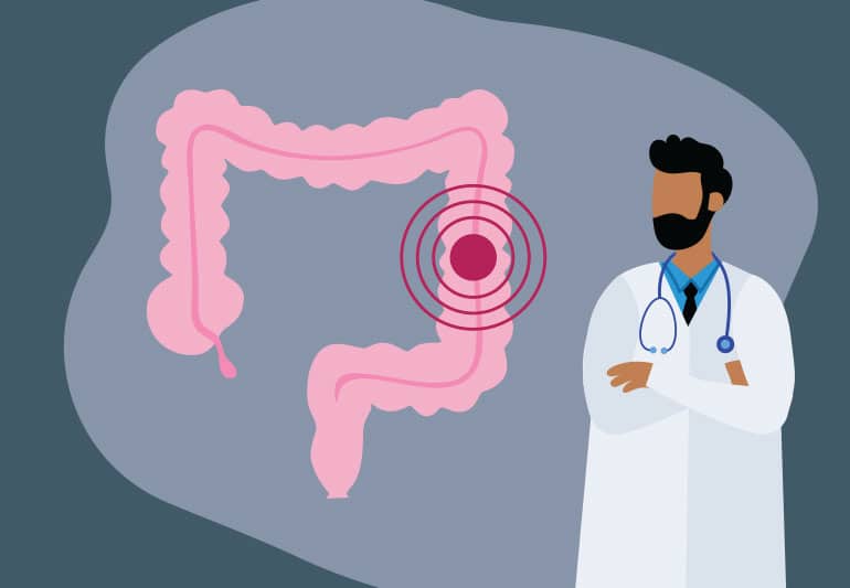 colorectal cancer doctor consultation kathmandu