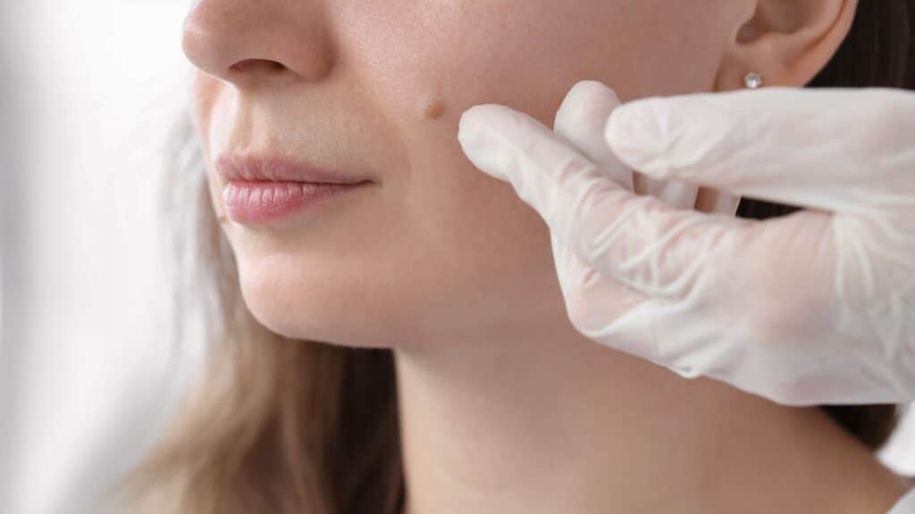Best Dermatologist checkup in Kathmandu