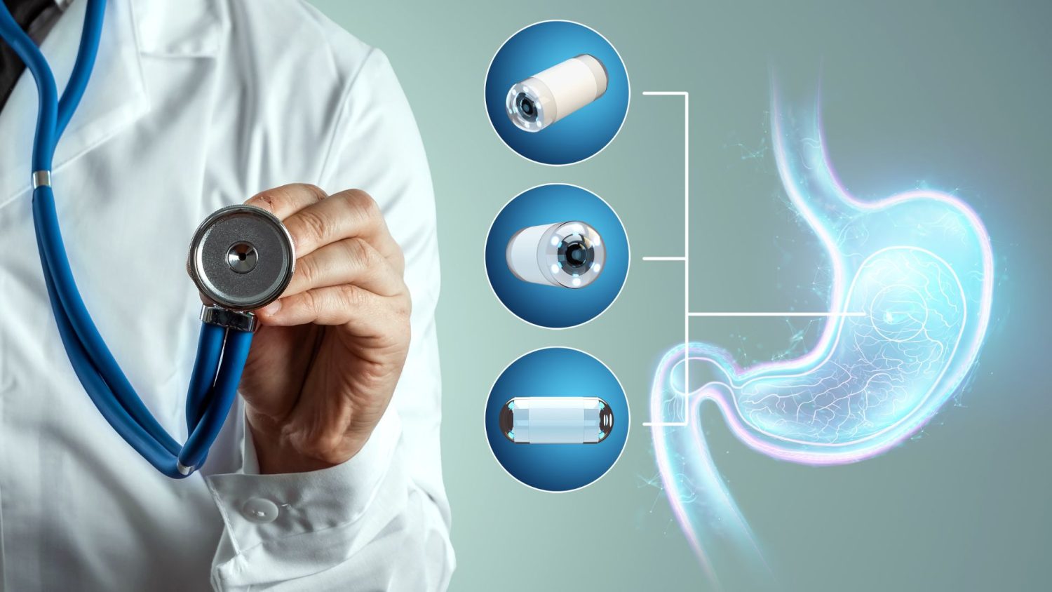 Capsule Endoscopy