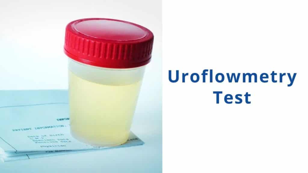 Uroflowmetry