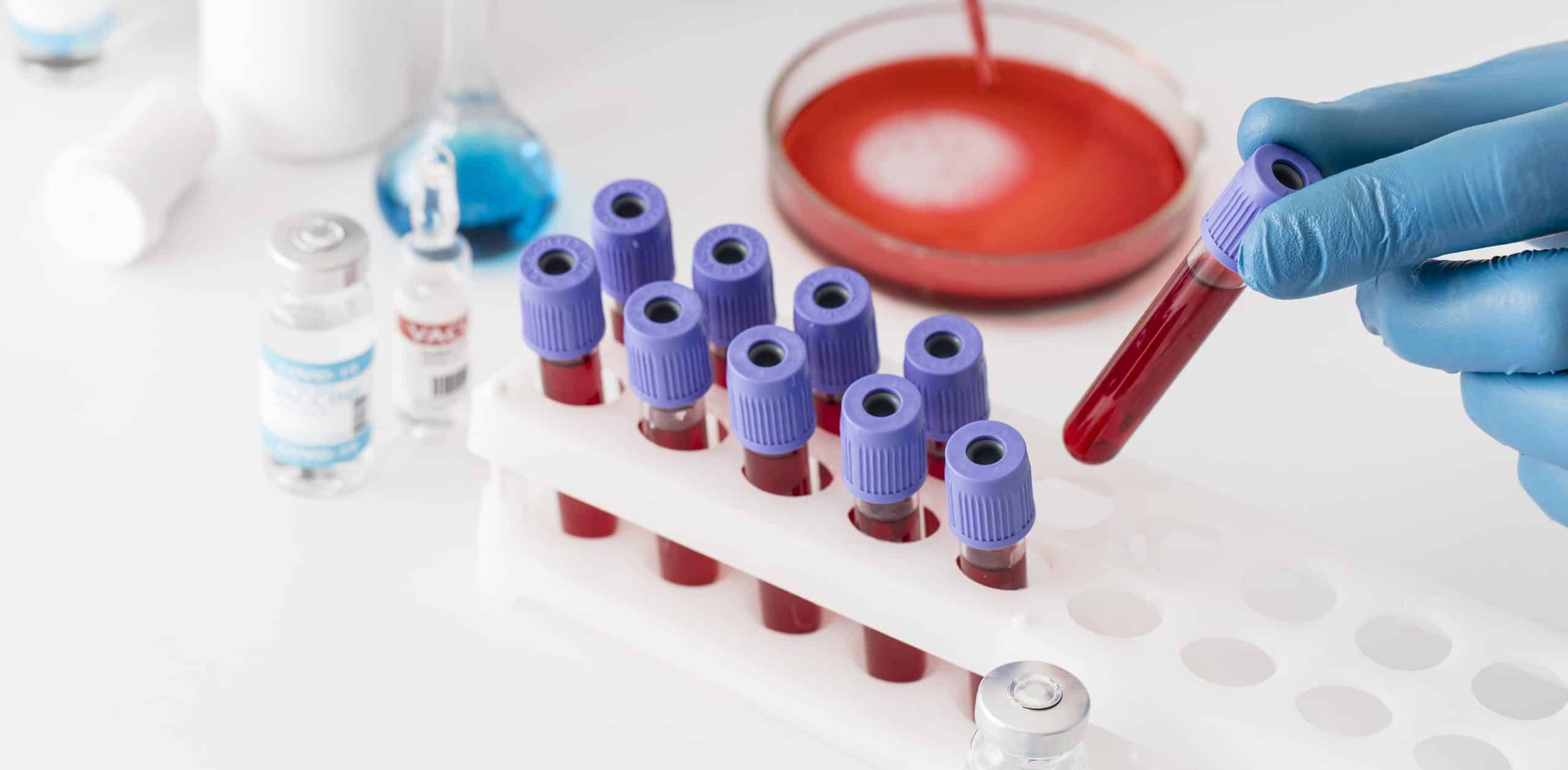 Blood Banks in Kathmandu, Lalitpur, and Bhaktapur | Contact Information