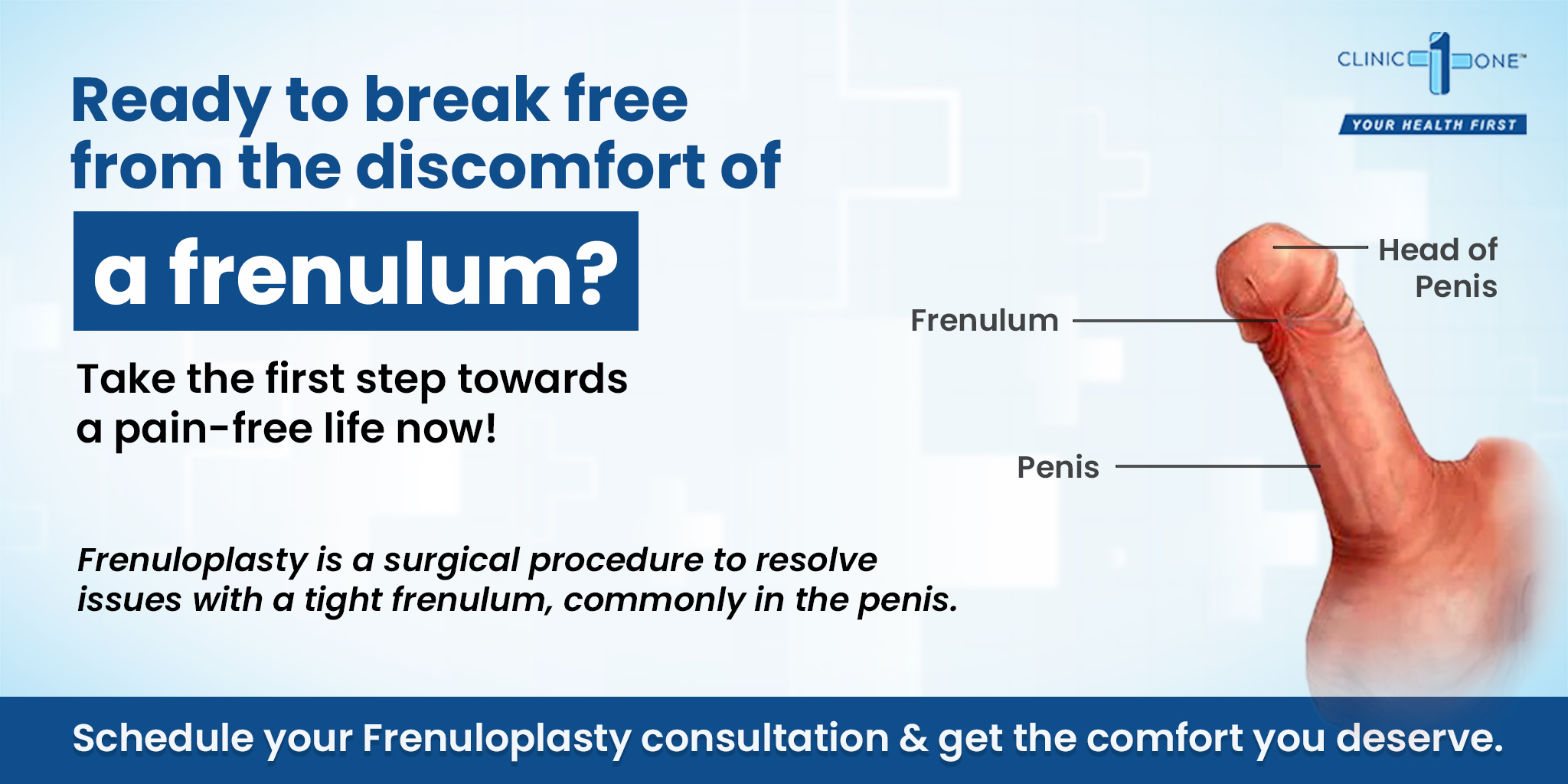 Frenuloplasty for Men