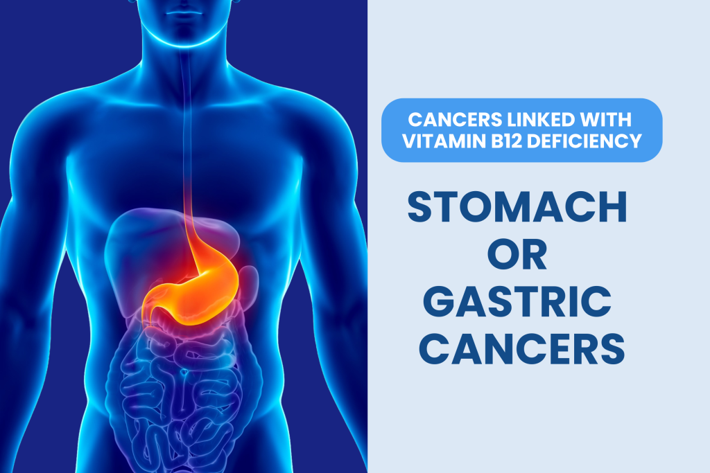 Vitamin B12 deficiency linked with blood cancer