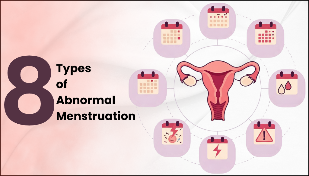 8 Types of Abnormal Menstruation: Causes, Symptoms, and Management