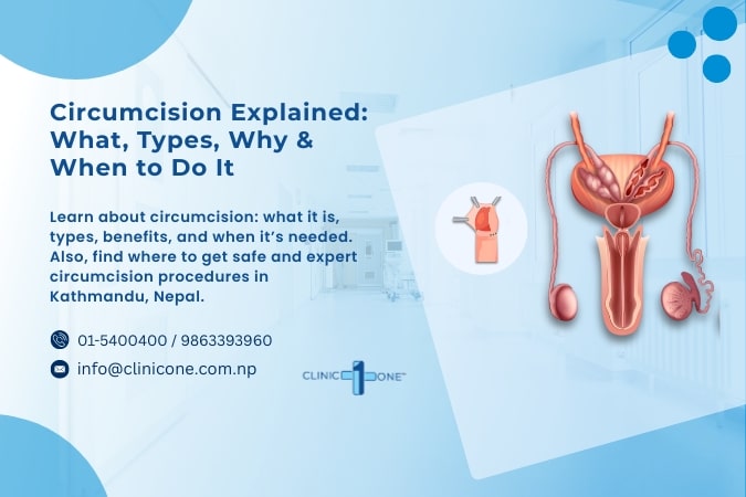 Circumcision Explained: What, Types, Why, When, and Where to Do It?