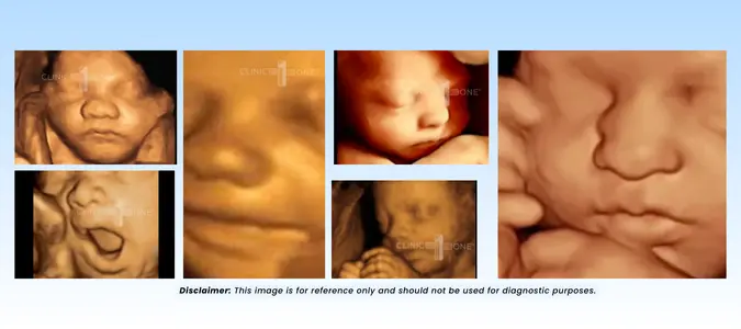 A graphic illustration of 3D and 4D ultrasound scan showing baby’s facial expressions and movements during pregnancy.