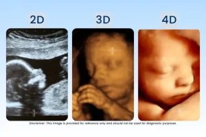 A side-by-side comparison of 2D vs 3D vs 4D ultrasound. It has a 2D scan, a detailed 3D fetal image, and a high resilution 4D ultrasound view during pregnancy.
