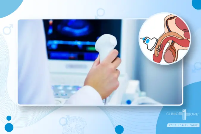 Doctor holding an ultrasound probe with a diagram showing male reproductive system and transrectal ultrasound procedure