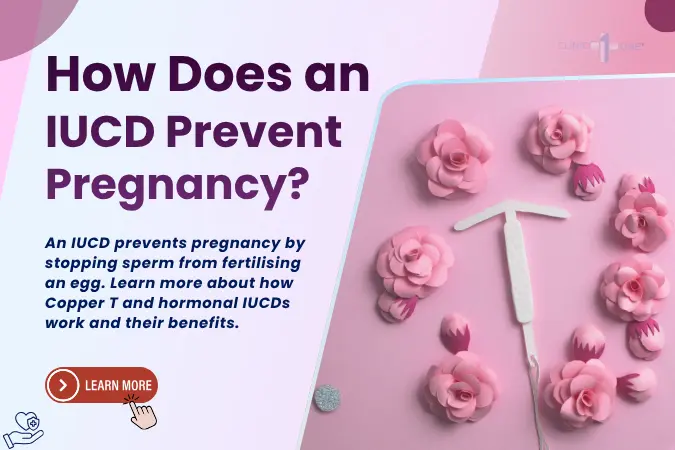 How Does an IUCD Prevent Pregnancy?